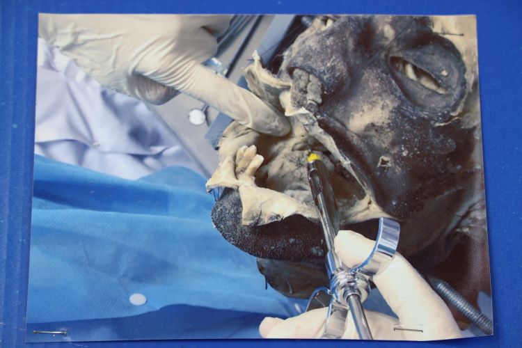 estudiantes cadáveres 