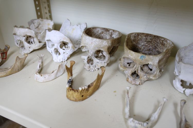 muestras cadavéricas 